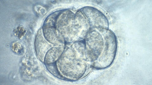 Embryo